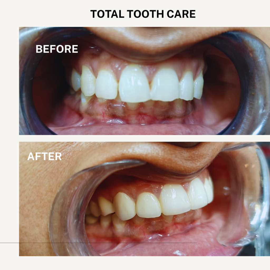 total tooth care